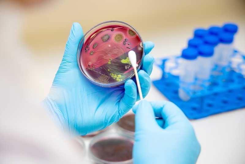 Ecco come lo stafilococco si aggancia alla pelle