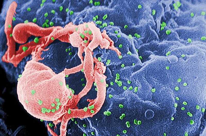Diagnosi di Hiv sono aumentate del 50%. Infezioni sessuali in crescita