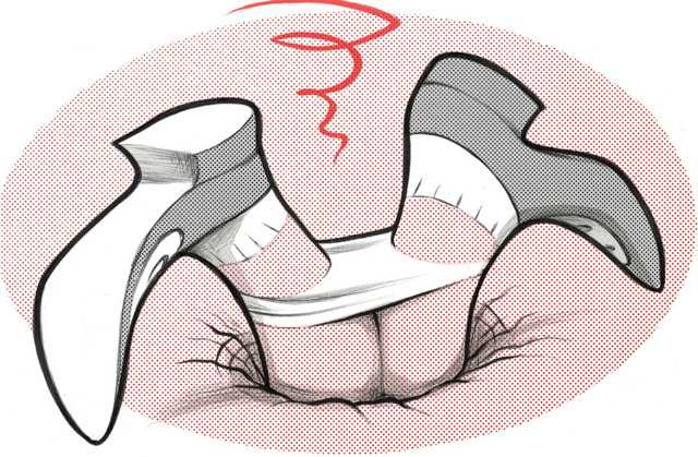 Sveltine: passione istantanea o mito erotico?