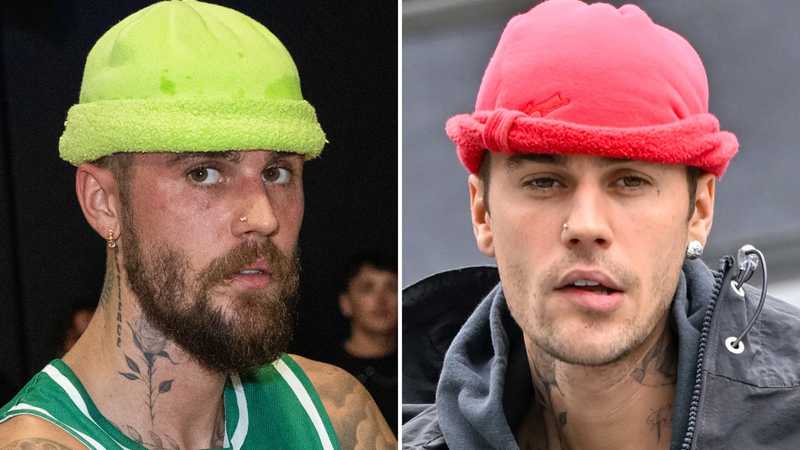 Barbe di Dicembre: Il Dilemma Finale – Peluria Selvaggia o Pelle Liscia?