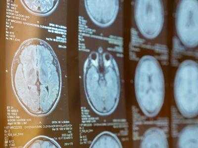 IA Rivela Sottotipi SM: Cura Rivoluzionaria!