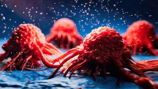 Cancro e Alzheimer: Il Paradosso Protettivo dei Tumori