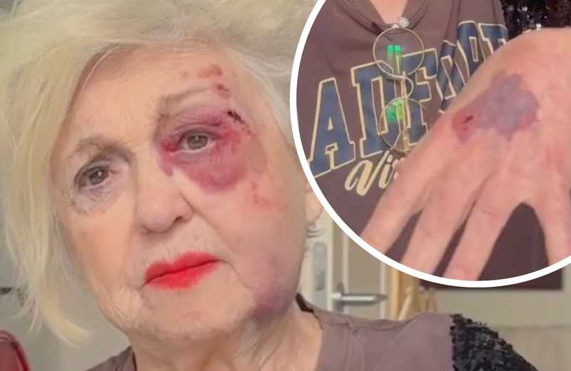 La Tragedia di un'Amicizia