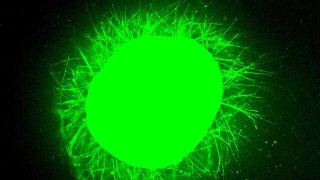 Nuova frontiera nella cura delle lesioni spinali