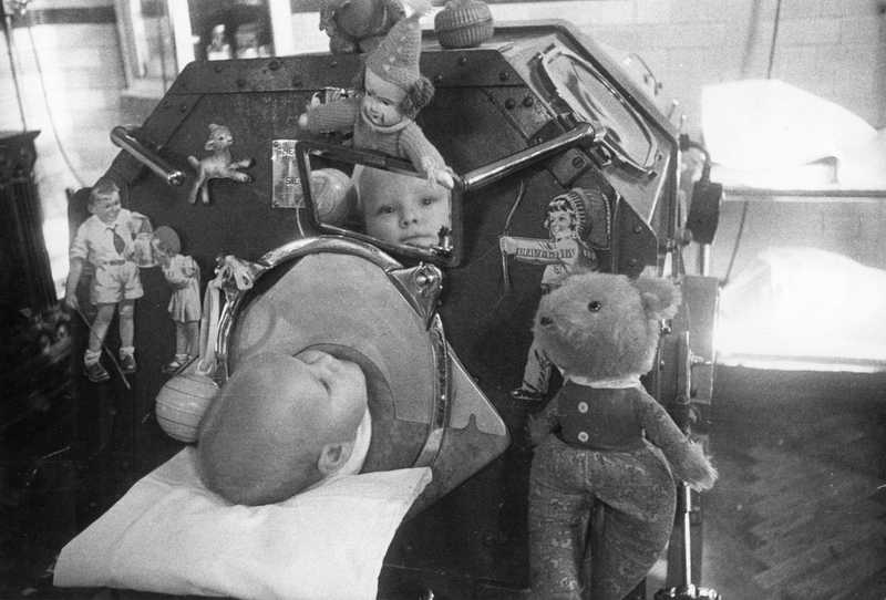 La poliomielite e le teorie alternative