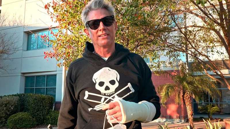 Jackass 5: Ultimo Capitolo del Franchise