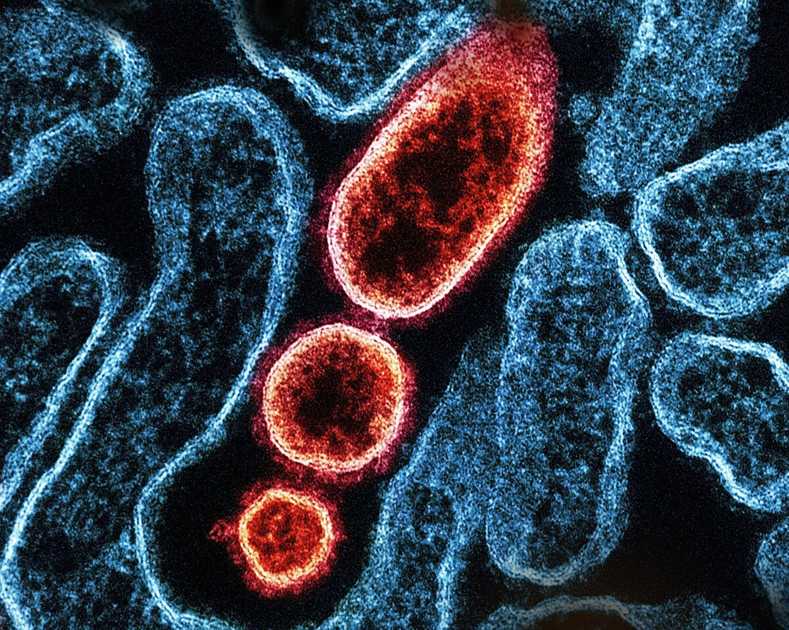 Infezioni Nosocomiali e Responsabilità Medica