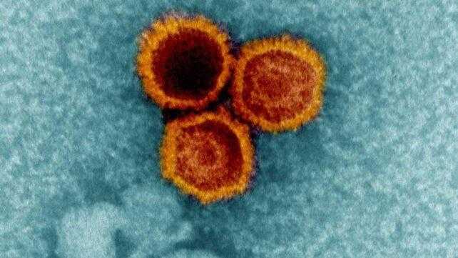Virus di Epstein-Barr e Sclerosi Multipla: Nuove Scoperte